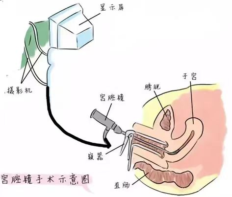 图片1(55).png